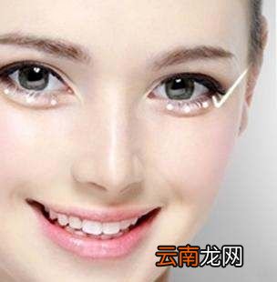 眼袋是怎样产生的,如何消除