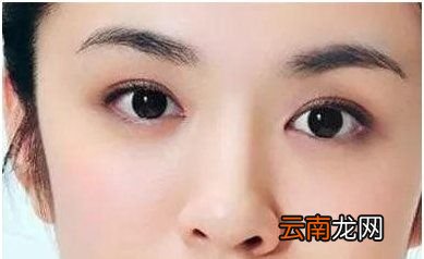 眼袋是怎样产生的,如何消除
