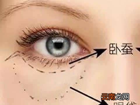 眼袋是怎样产生的,如何消除
