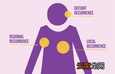 癌症为什么会复发