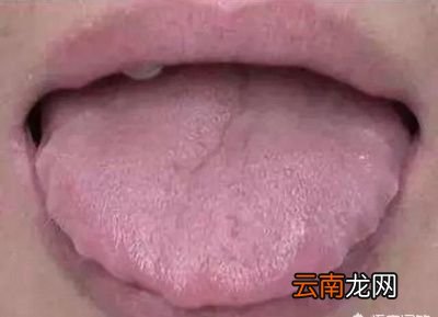 舌头有齿痕怎么调理