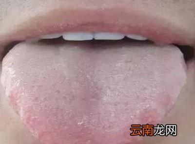 湿气重在舌苔上有什么表现呢