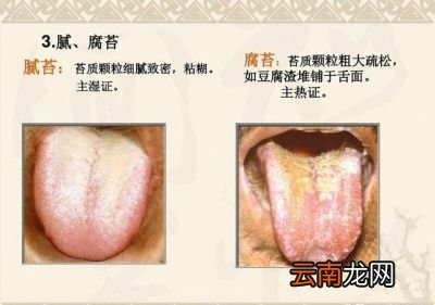湿气重在舌苔上有什么表现呢