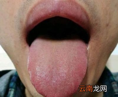 湿气有什么表现
