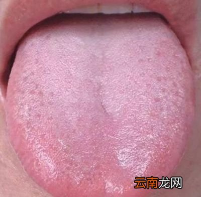 湿气有什么表现