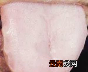 湿气有什么表现