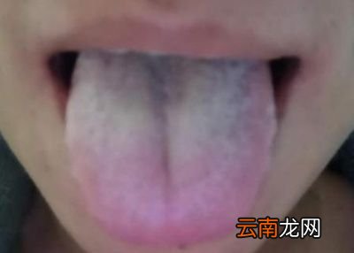 湿气有什么表现