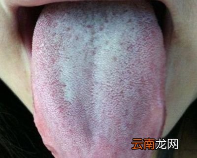 湿气有什么表现