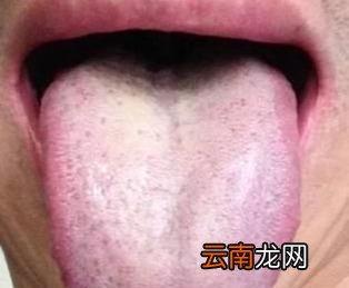 湿气有什么表现