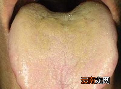 湿气有什么表现
