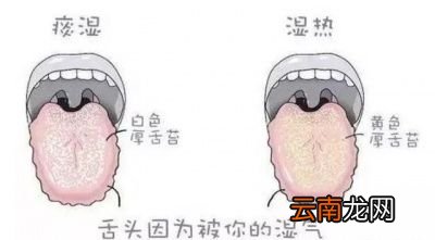 如果体内有痰湿一般我们会有哪些症状