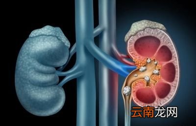 长期喝烧开的自来水对身体有危害吗