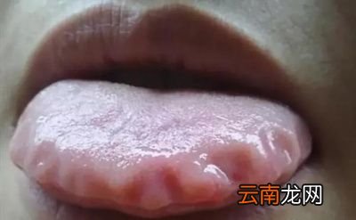 气虚和阳虚之间有什么联系呢