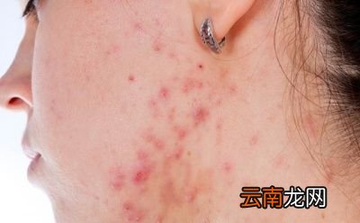 湿热体质如何调理呢