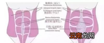 腹直肌分离常见于哪种情况