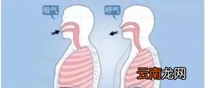 腹直肌分离常见于哪种情况