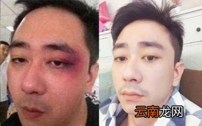 相声圈里发生过哪些令人尴尬无奈的奇葩事