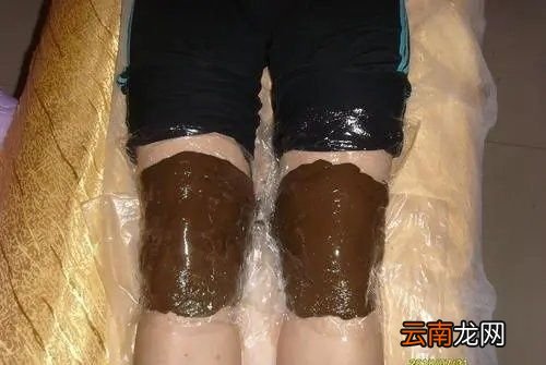 泥灸不适合哪些人群用