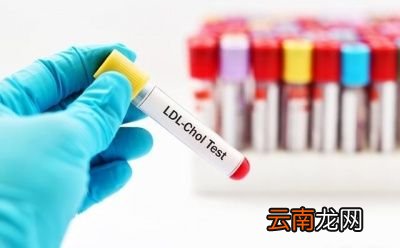 降低甘油三酯的方法有哪些