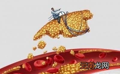 甘油三酯到底是什么呢