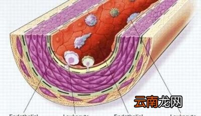 甘油三酯偏高怎么办