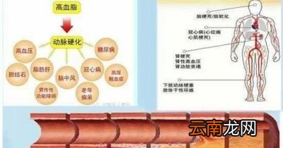 如何降低甘油三酯我们可以通过下面这3种方法