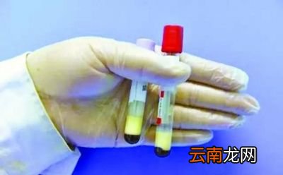 什么是甘油三酯