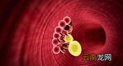 甘油三酯高是怎么回事