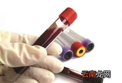 甘油三酯高是怎么回事