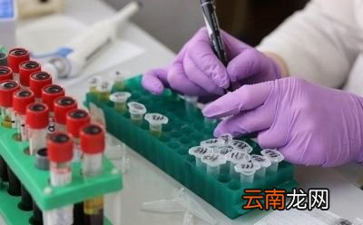 降甘油三酯的“冠军”是什么