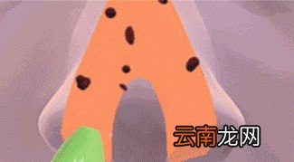 用生理盐水洗鼻究竟有哪些好处呢