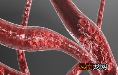 高血压吃芹菜有道理吗