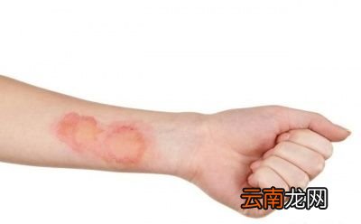 蜂蜜究竟有什么作用呢