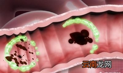 下面介绍几种食物常吃可保持体内肠道菌平衡