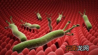 幽门螺杆菌到底是怎样的一种细菌呢