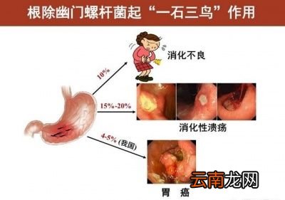 用过的碗筷会传播幽门螺旋杆菌吗