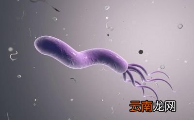 除此之外预防幽门螺杆菌感染注意以下几点