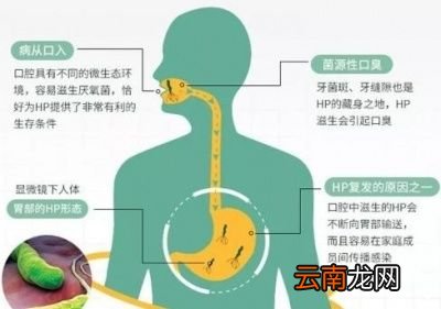 了解什么是幽门螺旋杆菌