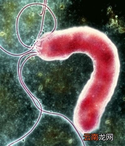 幽门螺杆菌是如何感染人的