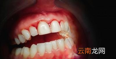 2元的维生素C和上百元的维生素C有没有区别