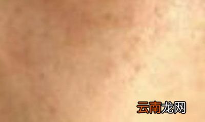 胶原蛋白氧化变黄为什么也会导致皮肤暗沉