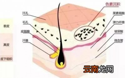 胶原蛋白氧化变黄为什么也会导致皮肤暗沉