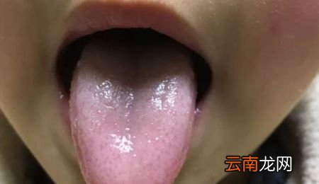 舌苔白厚怎么消除最快