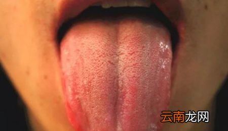 舌苔白厚怎么消除最快