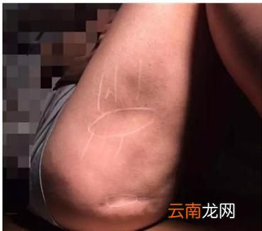 正确的减肥方法