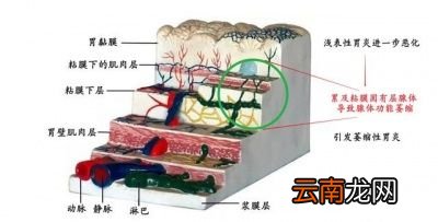 幽门螺旋菌感染的患者如何治疗呢