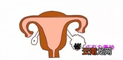 备孕遇到子宫内膜异位症应如何治疗
