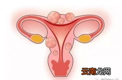 备孕遇到子宫内膜异位症应如何治疗
