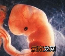 刚刚怀孕有五天要不要去医院检查
