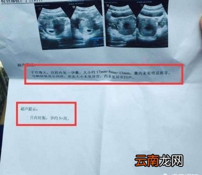 刚刚怀孕有五天要不要去医院检查